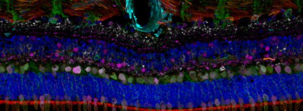 Intravital and spatial proteomic assessment of the rescue of inherited retinal degeneration by oral small molecule corrector therapy