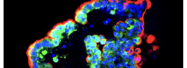 Alveolar organoid image courtesy of Dr Amany Ammar (UCL Respiratory)